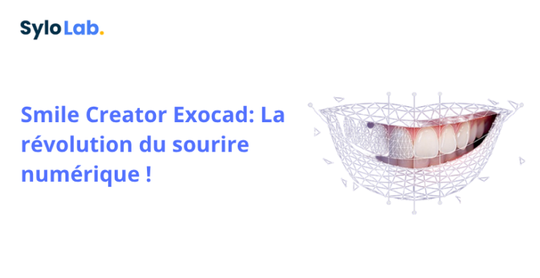 Smile Creator Exocad: la révolution du sourire numérique