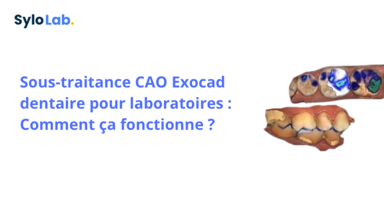 Sous-traitance CAO Exocad dentaire pour laboratoires : Comment ça fonctionne ?