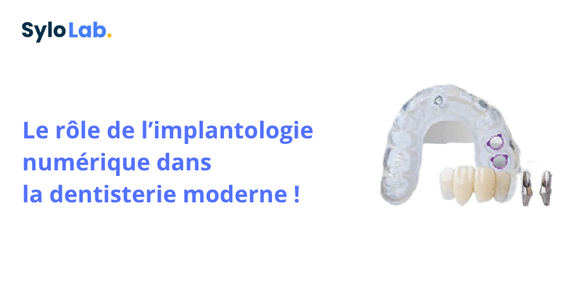 Le rôle de l’implantologie numérique dans la dentisterie moderne