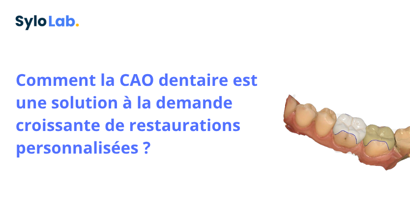 Comment la CAO dentaire est une solution à la demande croissante de restaurations personnalisées ?
