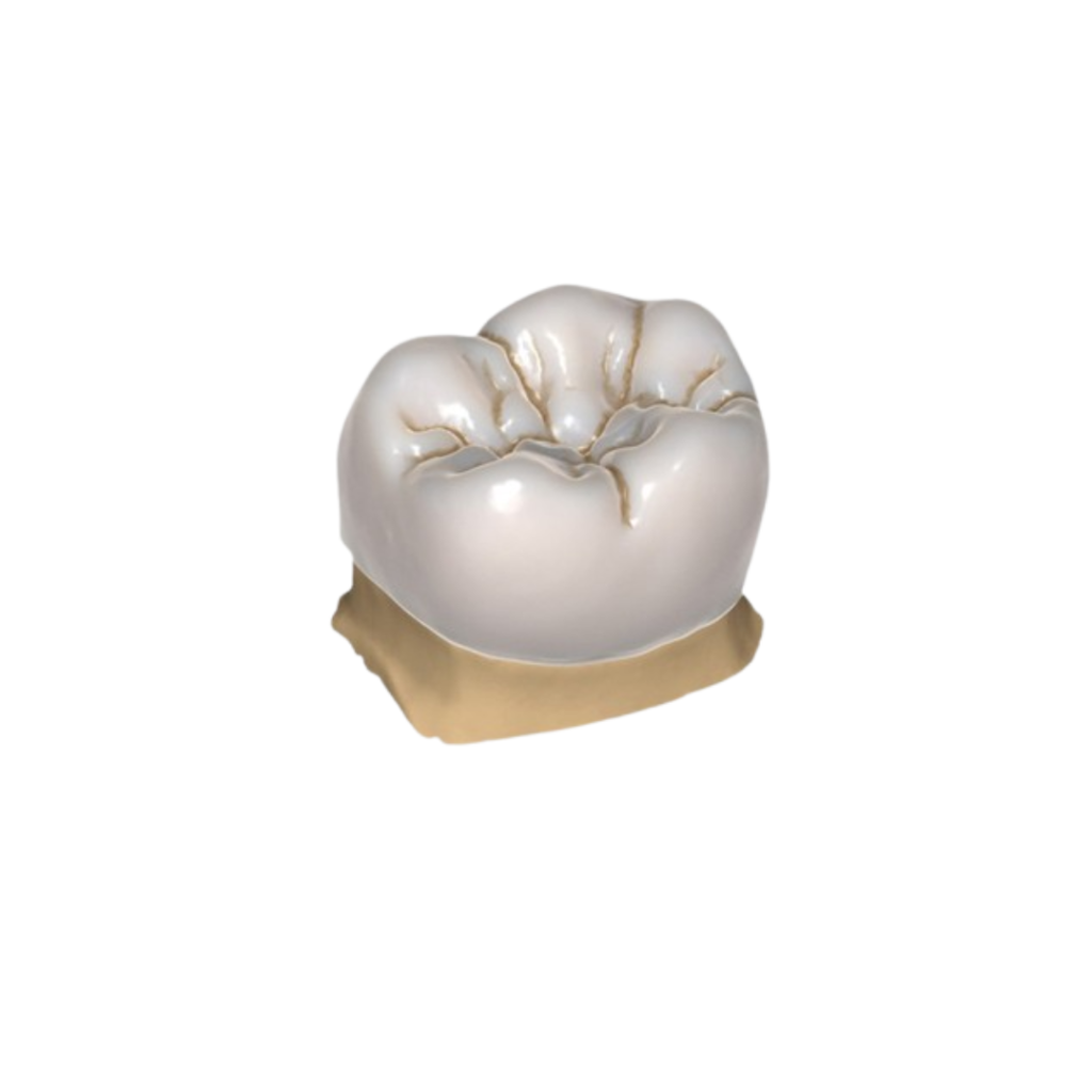 3D Design of Custom Crowns