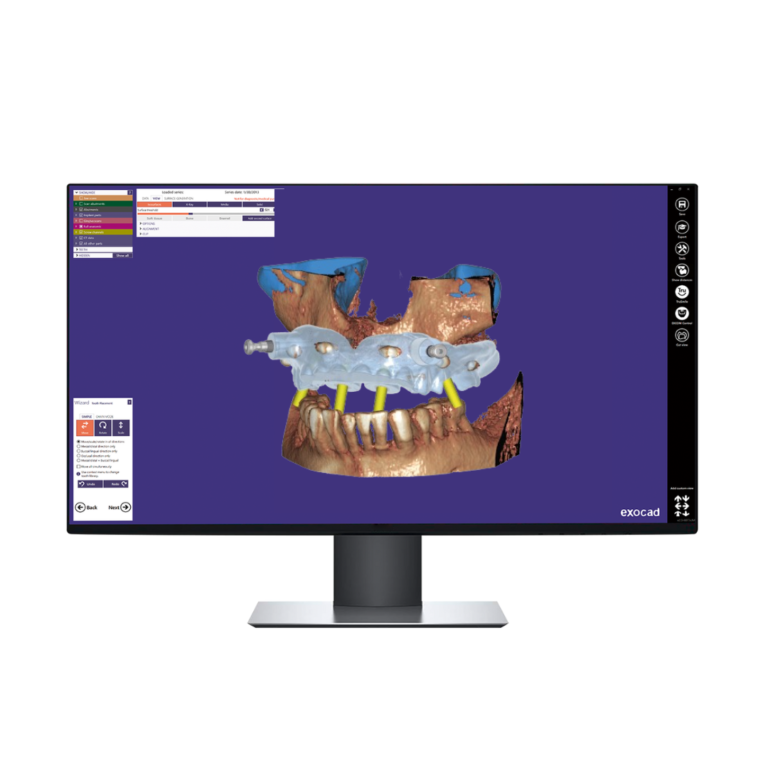 Conception 3D Guide Chirurgical