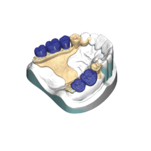3D Dental Chassis Design