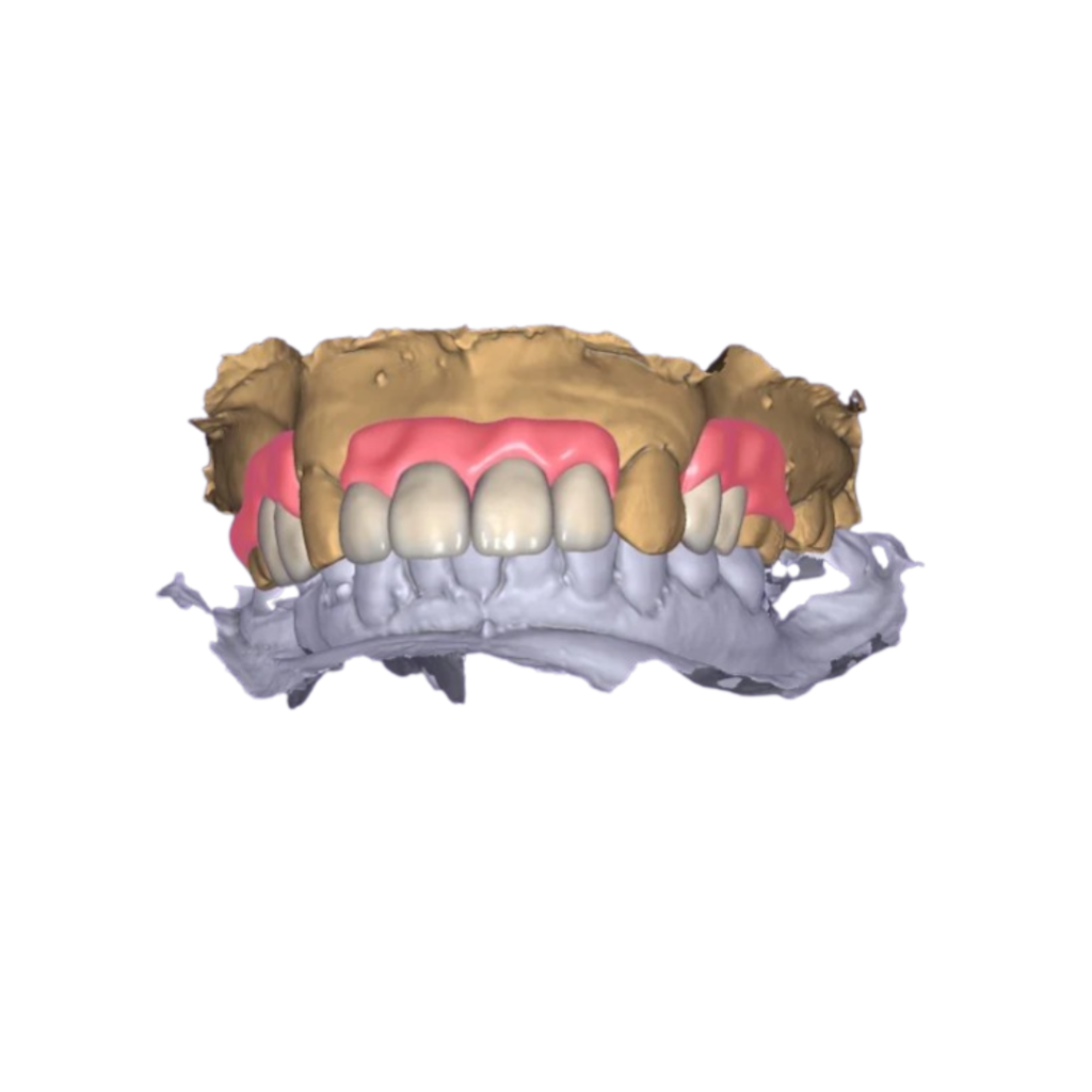 SyloLab creates 3D designs for all types of dental aligners, optimizing time and quality in dental laboratories.