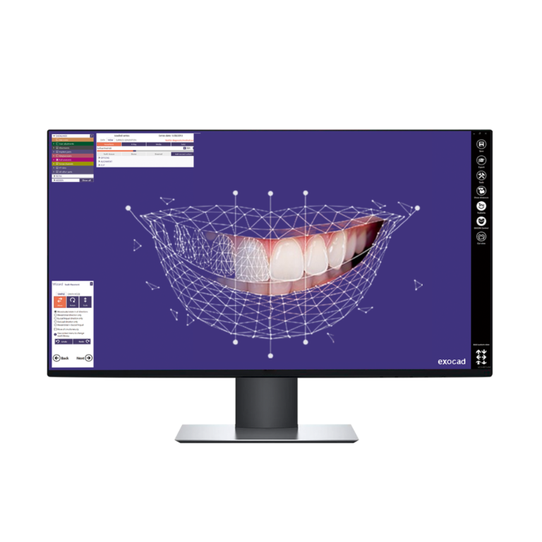 Conception 3D Smile D + Mock-up