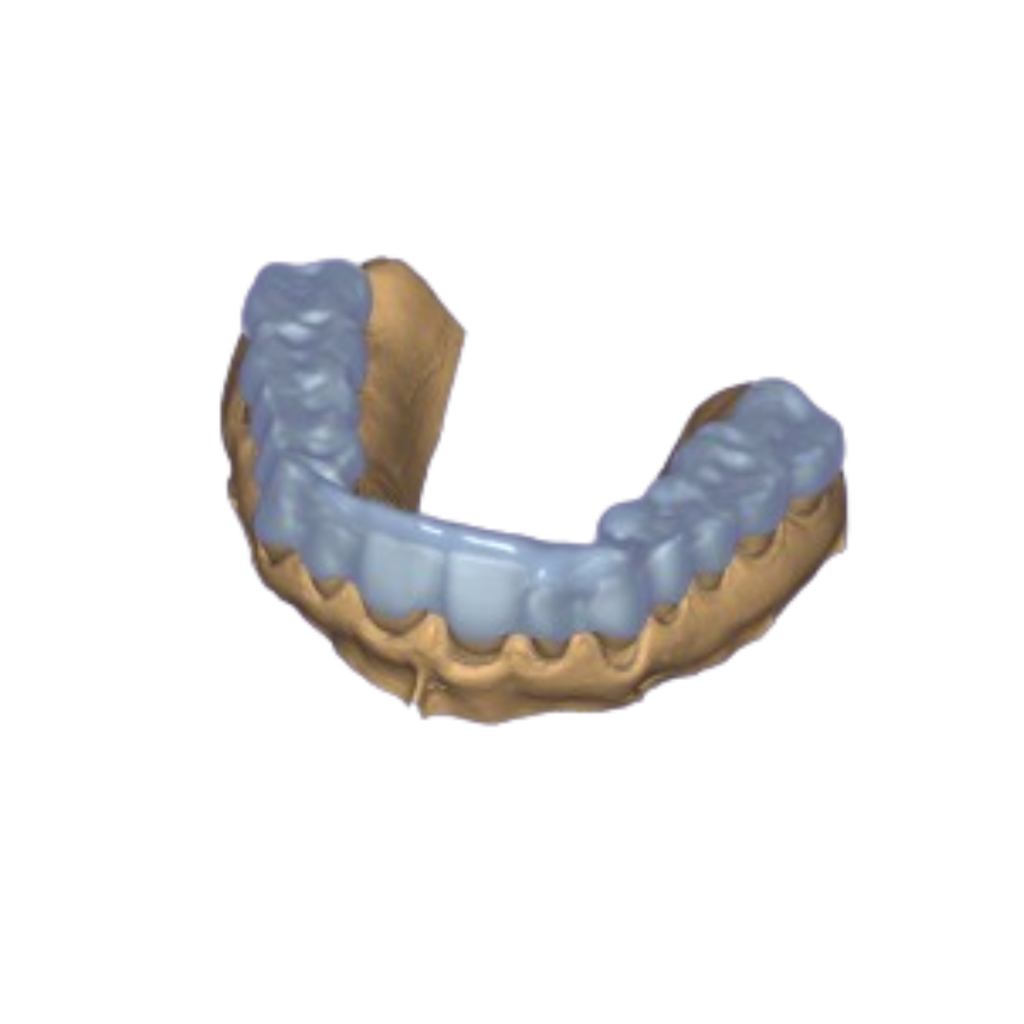 3D Dental Aligner Design