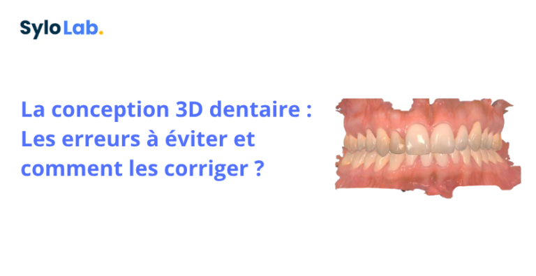 La conception 3D dentaire : Les erreurs à éviter et comment les corriger ?