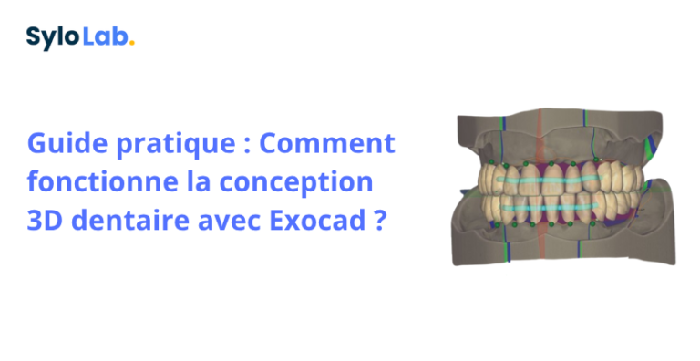 Guide pratique : Comment fonctionne la conception 3D dentaire avec Exocad ?