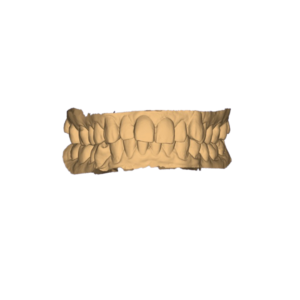 Dental Full Arch 3D Design