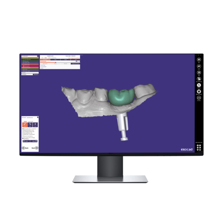 Conception 3D Pilier Personnalisé + Couronne