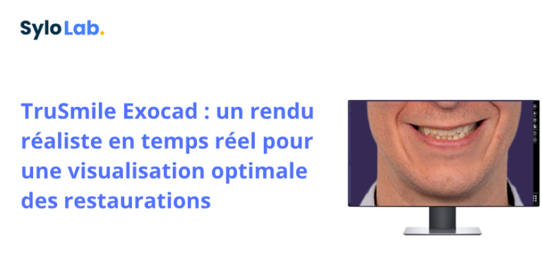 TruSmile Exocad : un rendu réaliste en temps réel pour une visualisation optimale des restaurations