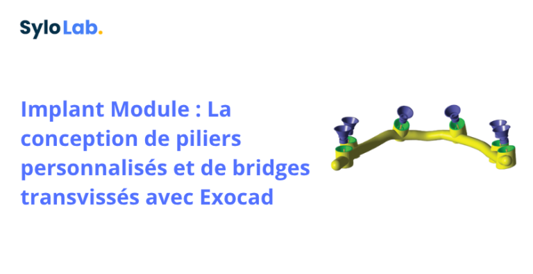 Implant Module : La conception de piliers personnalisés et de bridges transvissés avec Exocad