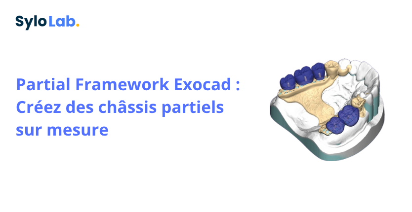 Partial Framework Exocad : Créez des châssis partiels sur mesure