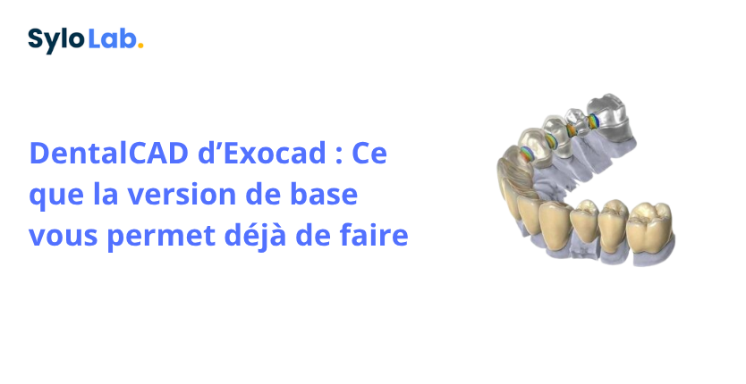 DentalCAD d’Exocad : Ce que la version de base vous permet déjà de faire