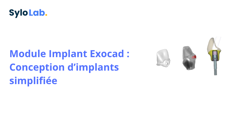 Module Implant Exocad : Conception d’implants simplifiée