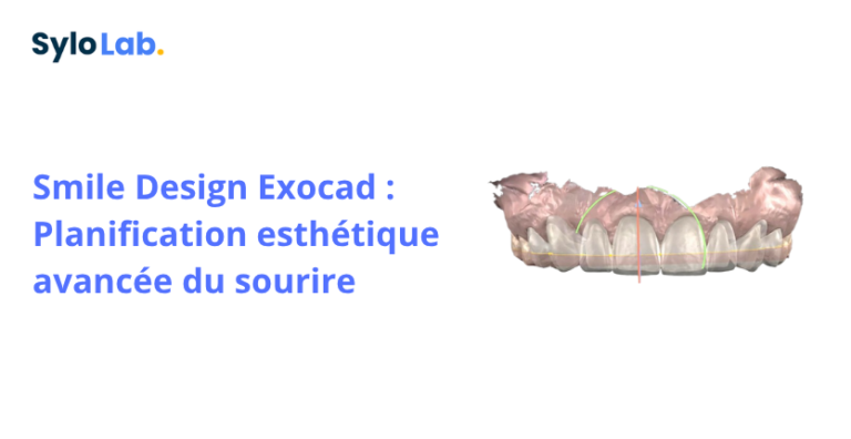 Smile Design Exocad : Planification esthétique avancée du sourire