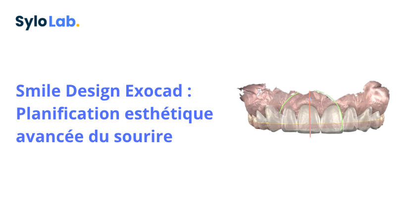 Smile Design Exocad : Planification esthétique avancée du sourire