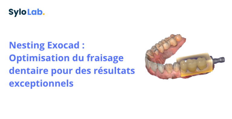 Nesting Exocad : Optimisation du fraisage dentaire pour des résultats exceptionnels