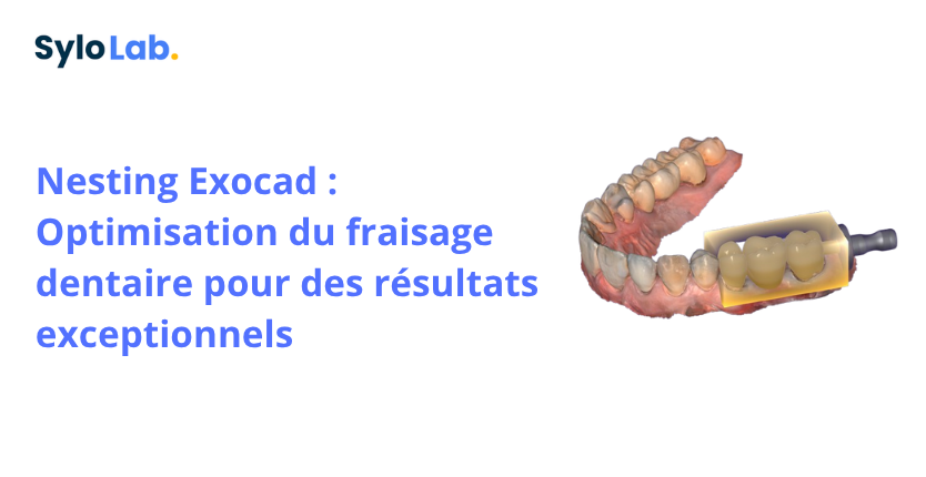 Nesting Exocad : Optimisation du fraisage dentaire pour des résultats exceptionnels